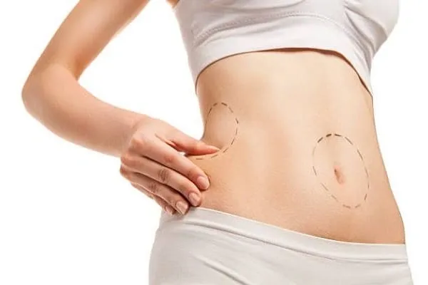 How Can I Get Rid Of Unwanted Fat?